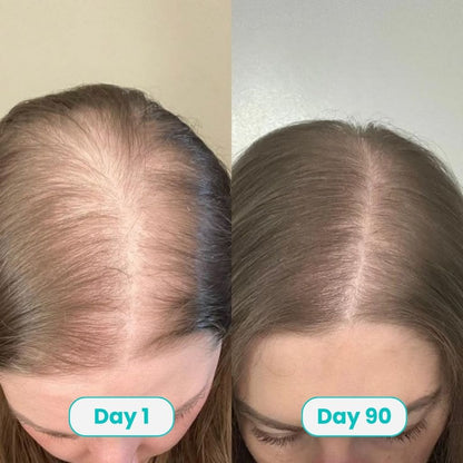 PDRN Hair Growth Serum