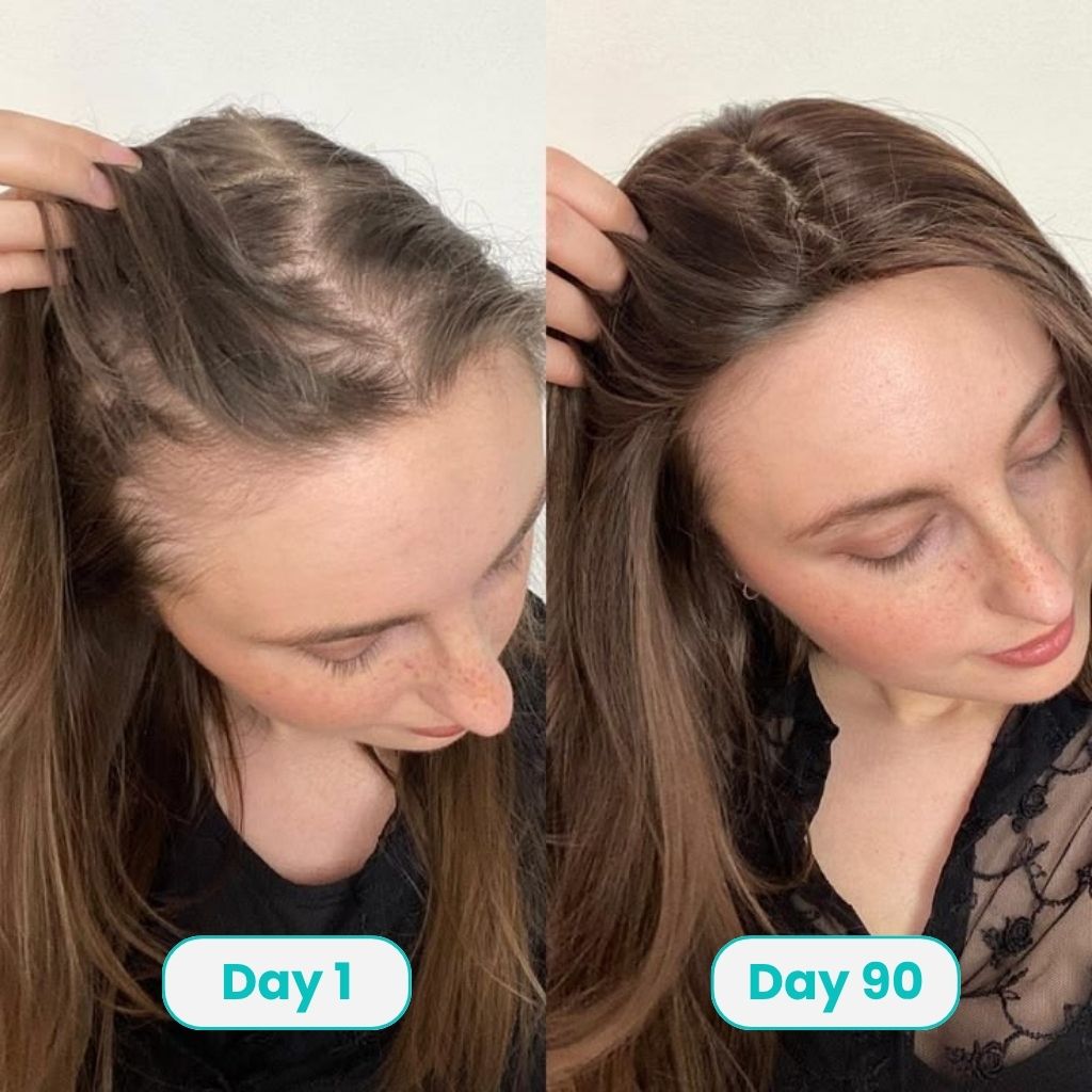 PDRN Hair Growth Serum