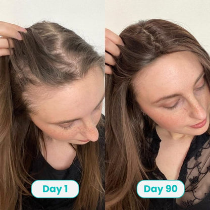 PDRN Hair Growth Serum